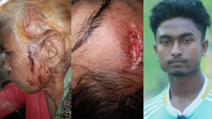 ছবি: গুরুতর আহত মা ও মেয়ে। ডাপাশে হামলায় নেতৃত্ব দেওয়া মোরশেদুল ইসলাম।